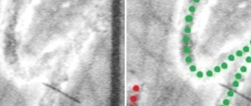 Белоруска исправила больничный лист и получила штраф 2000 рублей