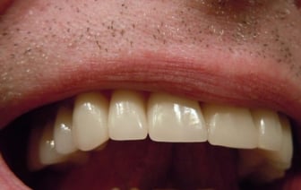 С 1 июля должны были снизить цены на стомуслуги – посмотрели, что в итоге