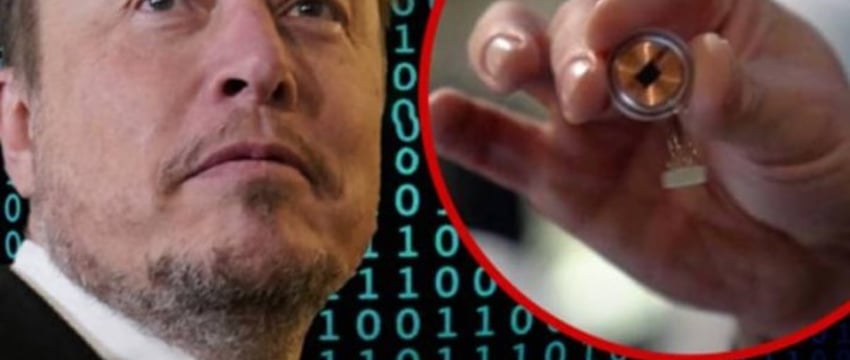 Компания Илона Маска Neuralink вживила первый имплант в мозг человека
