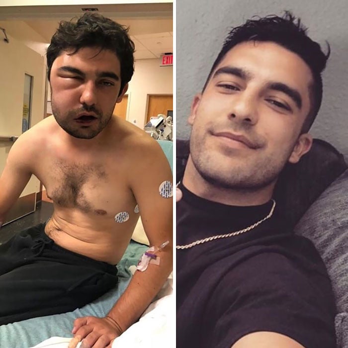 На фото показали людей, которые отказались от наркотиков и алкоголя