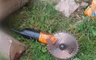 Болгарка попала в шею мужчине в Раубичах при заготовке дров