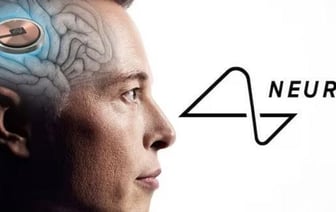 Мозговой имплант от Neuralink Илона Маска вживили третьему человеку