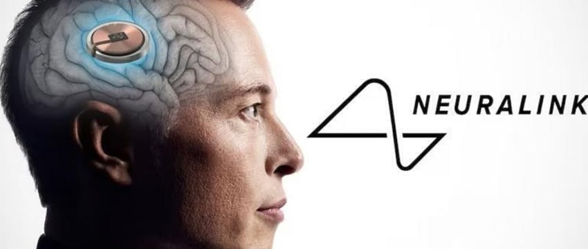 Мозговой имплант от Neuralink Илона Маска вживили третьему человеку