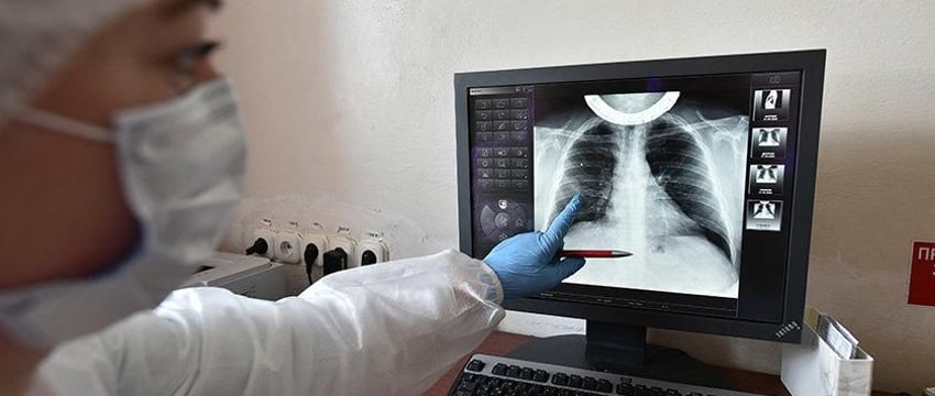 Каждый 10-й житель Гомеля обязан регулярно обследоваться на туберкулёз