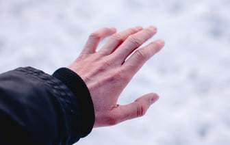 Что делать, если зимой руки становятся грубыми и сухими? 12 советов и 7 несложных домашних рецептов по уходу — Полезно