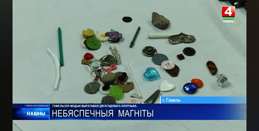 В Добруше 2-летний мальчик съел 20 магнитов — пришлось вырезать часть кишечника