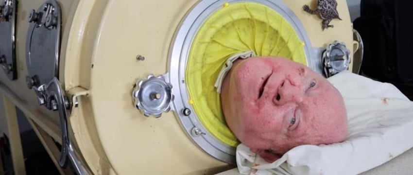 В США умер человек, более 70 лет проживший в капсуле из-за болезни