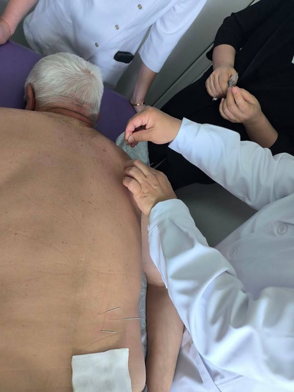 Китайский специалист дал мастер-класс по иглоукалыванию в ЦГБ Бреста