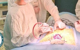 Девочке, выпавшей с 8 этажа, гродненские медики провели уникальную операцию