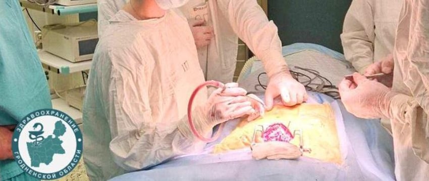 Девочке, выпавшей с 8 этажа, гродненские медики провели уникальную операцию
