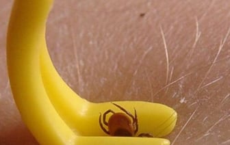 Как удалить присосавшегося клеща в домашних условиях, рассказали в Минздраве