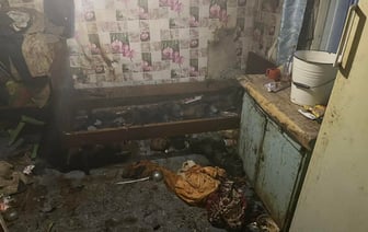 В Щучинском районе мужчина пострадал на пожаре, но не стал обращаться в больницу — что было дальше