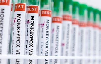 Первый случай заражения оспой у человека, вернувшегося из Саудовской Аравии, сообщен в Пакистане.