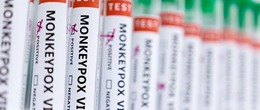 Первый случай заражения оспой у человека, вернувшегося из Саудовской Аравии, сообщен в Пакистане.