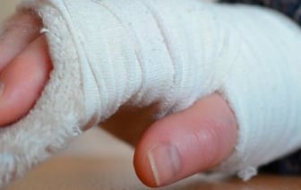 Белорус сломал жене палец. Придется выплатить штраф и моральную компенсацию