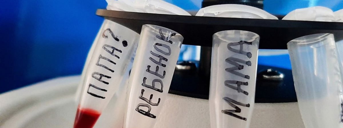 Из пяти ни одного. Судмедэксперты на примере показали, кому из белорусов стоит пройти ДНК-тест на отцовство