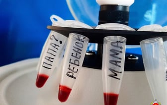 Из пяти ни одного. Судмедэксперты на примере показали, кому из белорусов стоит пройти ДНК-тест на отцовство