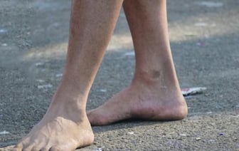 Житель Бреста шел по городу без штанов