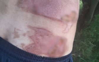 Белорусу в TikTok попалось видео, где он спит на вечеринке с горящей футболкой