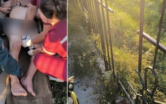 Житель Бреста напоролся на штырь забора