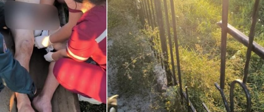 Житель Бреста напоролся на штырь забора
