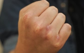 Житель Барановичей на протяжении нескольких месяцев бил жену. Чем всё закончилось?