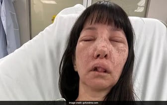 Женщина из США получила ужасные травмы после того, как ее укусили смертоносные пауки.