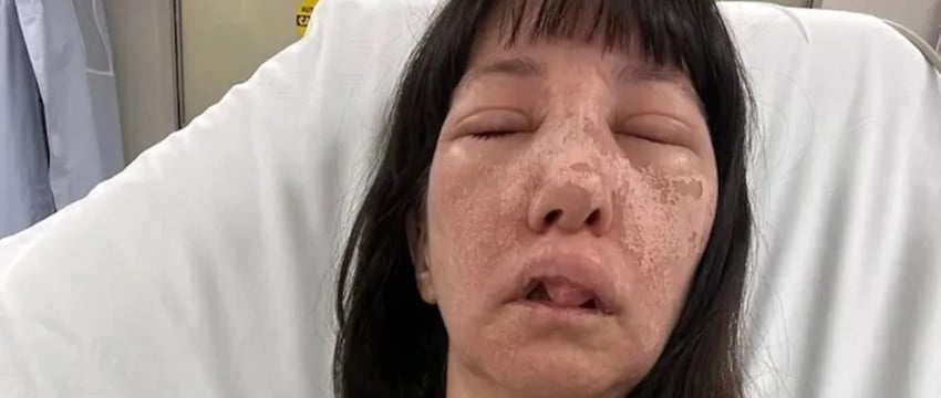 Женщина из США получила ужасные травмы после того, как ее укусили смертоносные пауки.