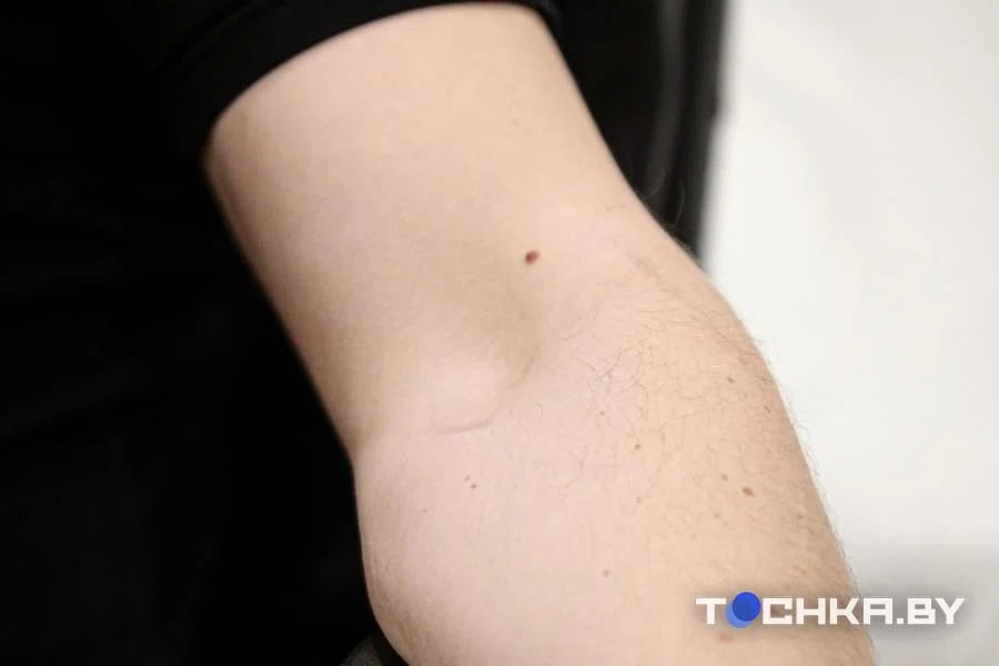 Исповедь бывшего наркомана из Беларуси