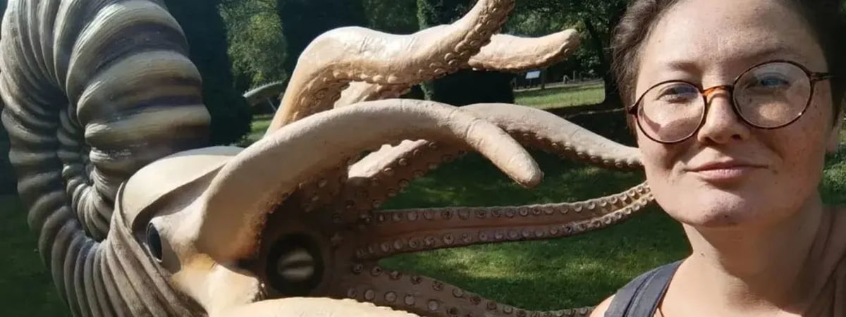 Последствия COVID-19: белоруска рассказала, как болезнь довела её до операции