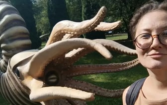 Последствия COVID-19: белоруска рассказала, как болезнь довела её до операции