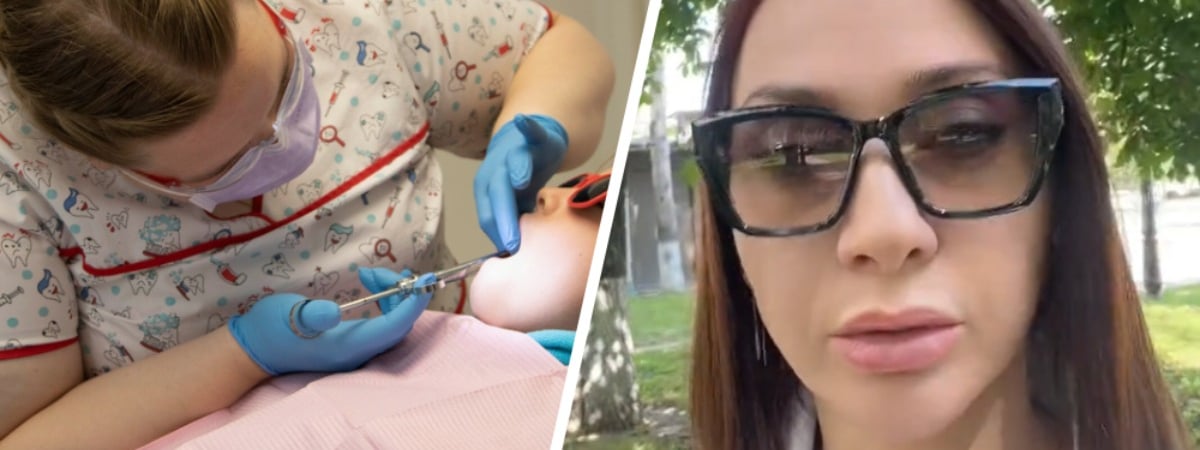 «Где такие цены?» — Белоруска рассказала в TikTok о лечении зуба за 900 рублей. У комментаторов возникли вопросы — Видео