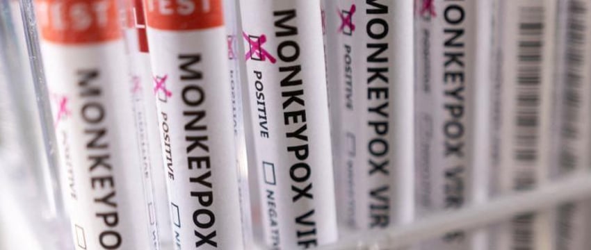 Минздрав отчитался по ситуации с оспой обезьян в Беларуси