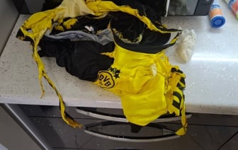 Одежда вспыхнула на ребенке в Барановичах