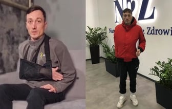 «Терпеть эту боль могу, но видеть эту руку…» В Варшаве белорус получил тяжелую травму, деньги на лечение собрали меньше чем за сутки