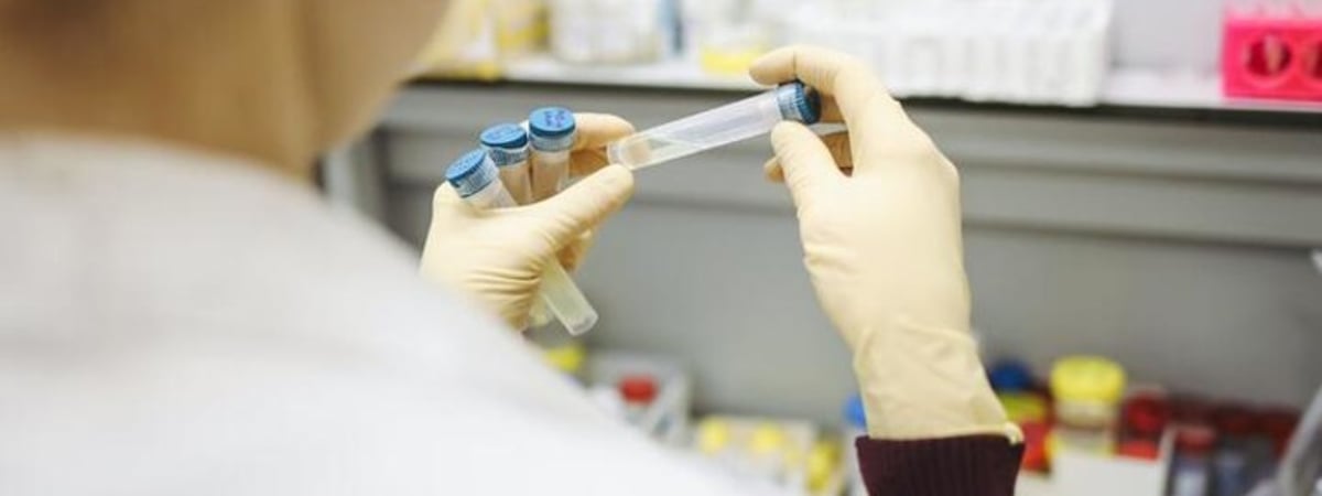 Ученые предложили принципиально новую причину болезни Альцгеймера