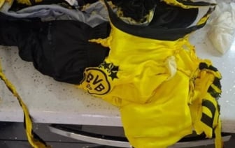 В Барановичах 9-летний мальчик получил ожоги из-за загоревшейся на нем одежды