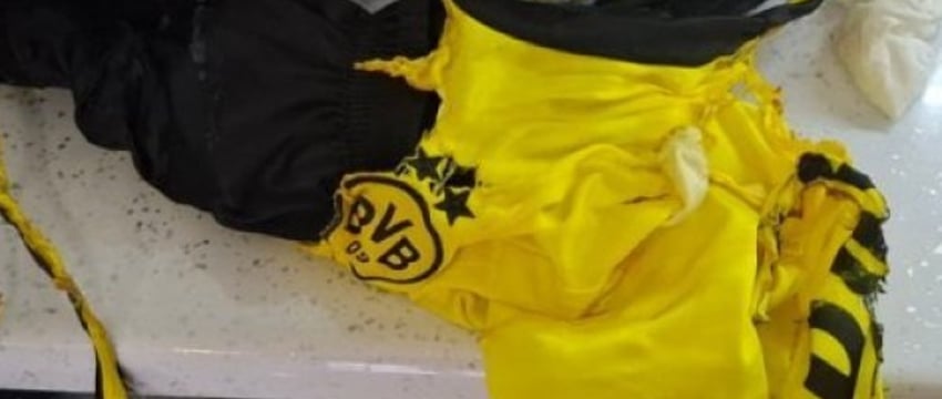 В Барановичах 9-летний мальчик получил ожоги из-за загоревшейся на нем одежды
