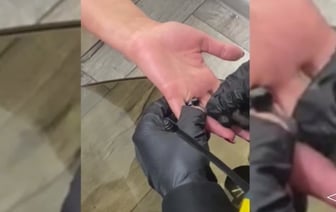Витебские спасатели помогли женщине снять кольцо с опухшего пальца
