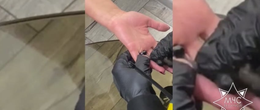 Витебские спасатели помогли женщине снять кольцо с опухшего пальца