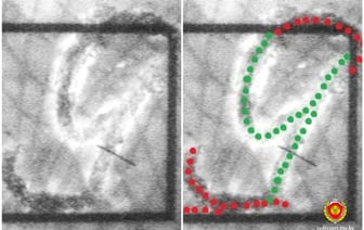 Женщина “продлила” себе больничный на 5 дней. Во что это вылилось?