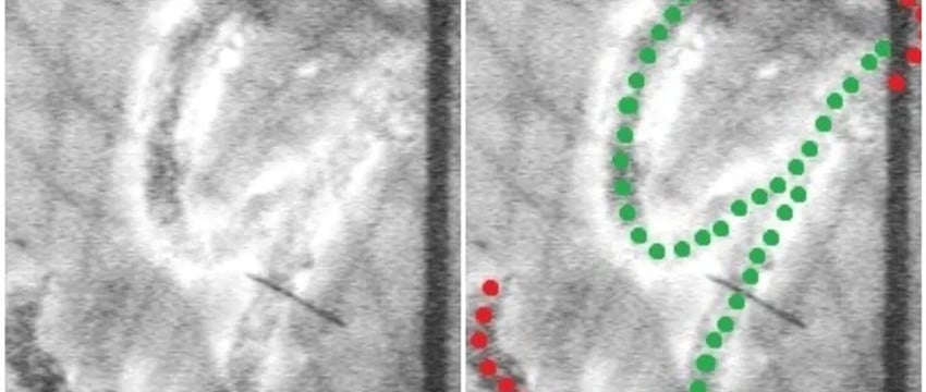 Женщина “продлила” себе больничный на 5 дней. Во что это вылилось?