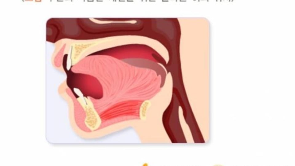 충격적인 원래 혀의 위치.