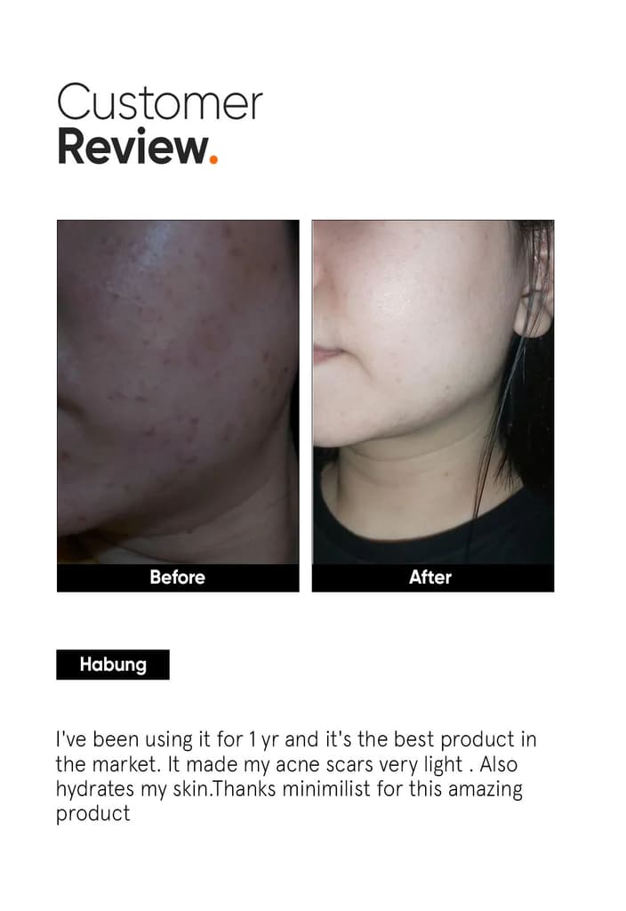 Alpha Arbutin 2% Face Serum — photo 5
