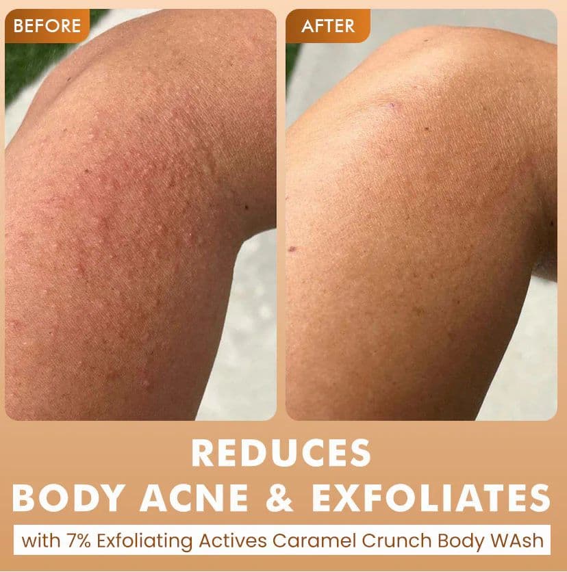 De-Tan & Exfoliating Body Washes (Set of 2)