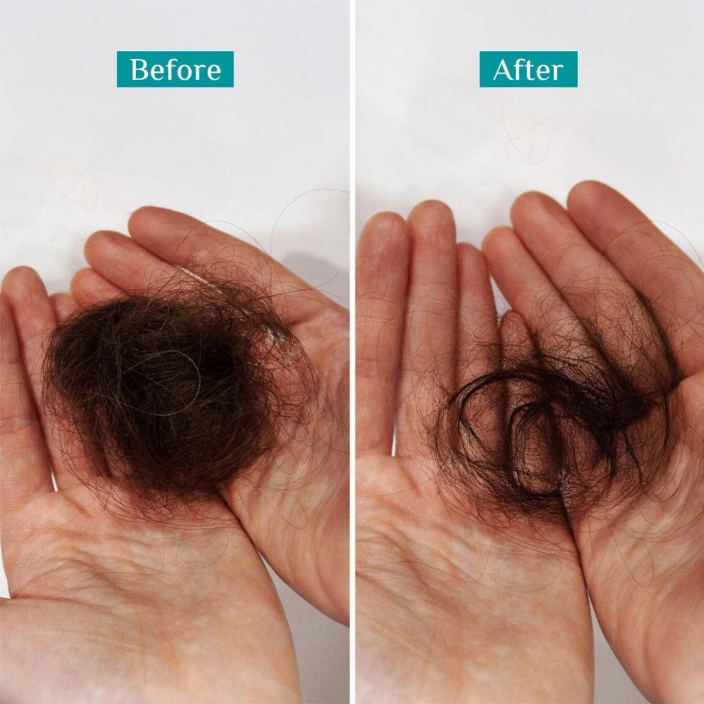 Redensyl & Anagain Hairfall Control Shampoo — photo 9