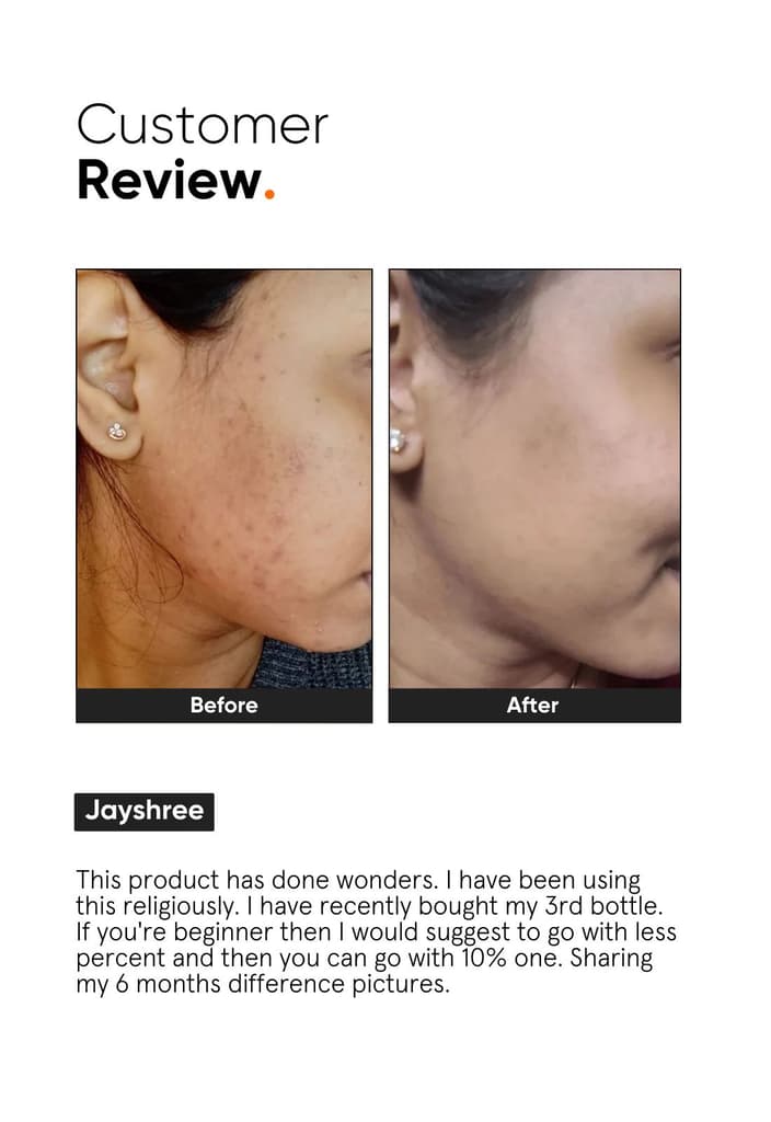 Niacinamide 10% Face Serum — photo 5