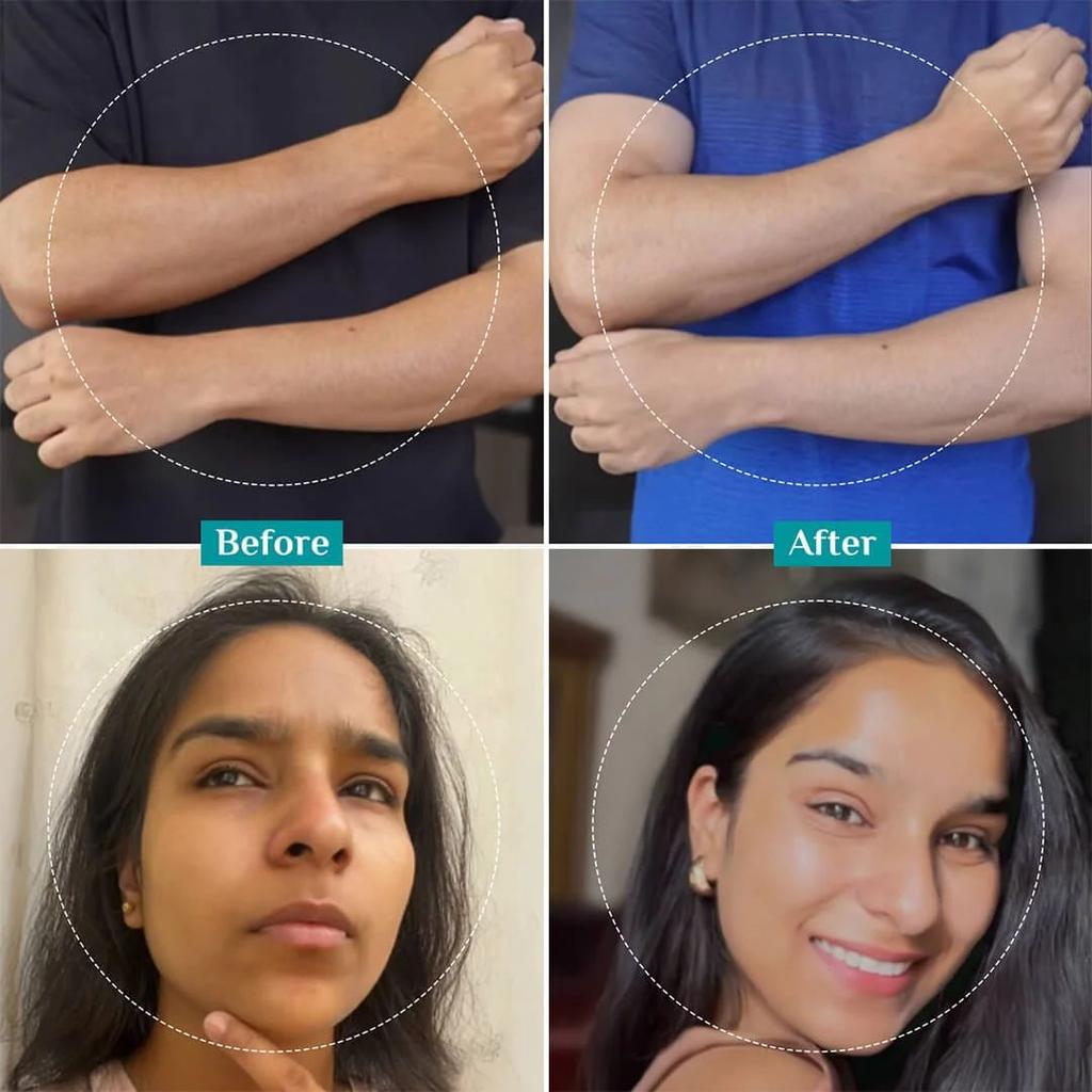25% AHA, 2% BHA, 5% PHA Peeling Solution