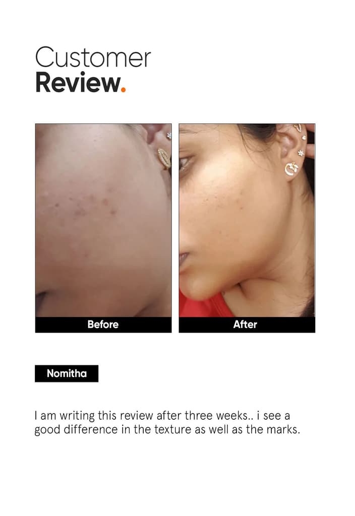AHA PHA BHA 32% Face Peel — photo 5