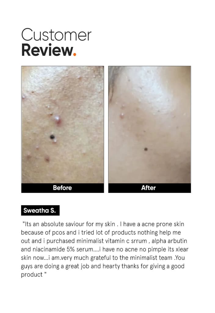 Vitamin C 10% Face Serum — photo 5